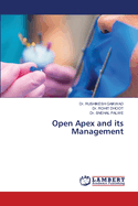 Open Apex and its Management