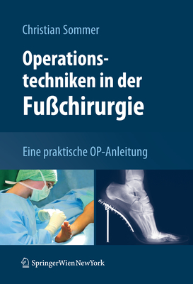 Operationstechniken in Der Fu?chirurgie: Eine Praktische Op-Anleitung - Sommer, Christian