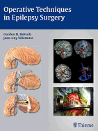 Operative Techniques in Epilepsy Surgery - Baltuch, Gordon H