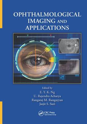 Ophthalmological Imaging and Applications - Ng, E. Y. K. (Editor), and Acharya, U. Rajendra (Editor), and Rangayyan, Rangaraj M. (Editor)