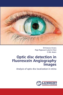 Optic disc detection in Fluorescein Angiography Images - Avvaru, Srinivasulu, and Lakshmi Devi, Raja Rajeswari, and Aslam, C MD