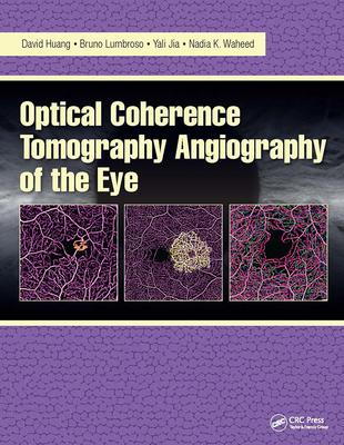 Optical Coherence Tomography Angiography of the Eye: OCT Angiography - Huang, David, MD, PhD, and Lumbroso, Bruno, MD, and Jia, Yali, PhD