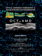 Optical Coherence Tomography in Age-Related Macular Degeneration