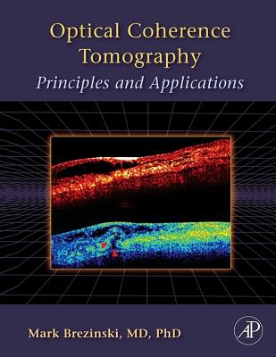 Optical Coherence Tomography: Principles and Applications - Brezinski, Mark E