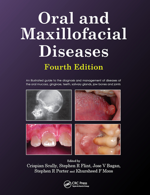 Oral and Maxillofacial Diseases, Fourth Edition - Scully, Crispian, CBE, and Flint, Stephen