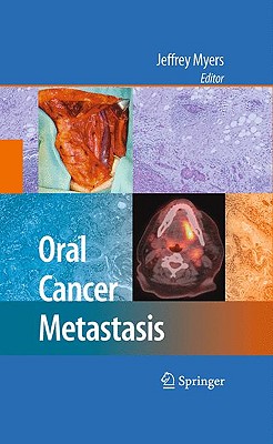 Oral Cancer Metastasis - Myers, Jeffrey (Editor)