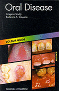 Oral Disease: Colour Guide