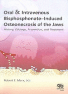 Oral & Intravenous Bisphosphonate-Induced Osteonecrosis of the Jaws: History, Etiology, Prevention, and Treatment