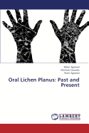 Oral Lichen Planus: Past and Present