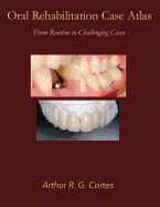 Oral Rehabilitation Case Atlas: From Routine to Challenging Cases