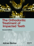 Orthodontic Treatment of Impacted Teeth, Second Edition