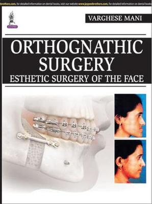 Orthognathic Surgery: Esthetic Surgery of the Face - Mani, Varghese