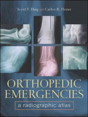 Orthopedic Emergencies: A Radiographic Altas - Flores, Carlos R, and Haig, Scott V, M.D.