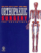 Orthopedic Surgery: The Essentials
