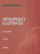 Orthopedics Illustrated