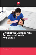 Ortodontia Osteog?nica Periodontalmente Acelerada