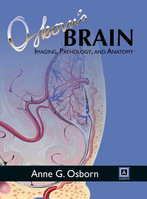 Osborn's Brain - Osborn, Anne G, MD