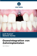 Osseointegration von Zahnimplantaten