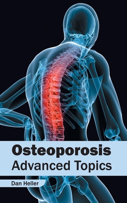 Osteoporosis: Advanced Topics - Heller, Dan (Editor)