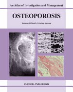 Osteoporosis: An Atlas of Investigation and Management