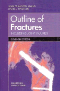 Outline of fractures, including joint injuries.