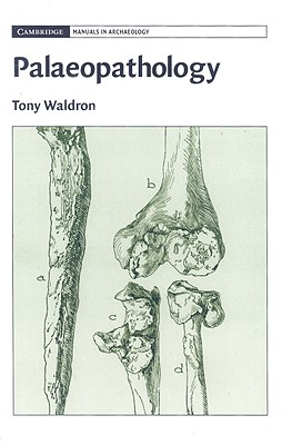 Palaeopathology - Waldron, Tony