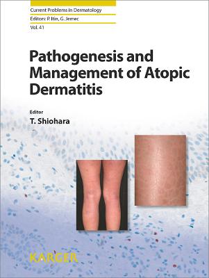 Pathogenesis and Management of Atopic Dermatitis - Shiohara Tetsuo Ed