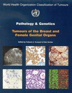 Pathology and Genetics of Tumours of the Breast and Female Genital Organs