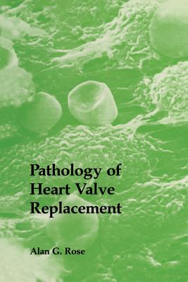 Pathology of Heart Valve Replacement - Rose, A G