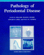 Pathology of periodontal disease