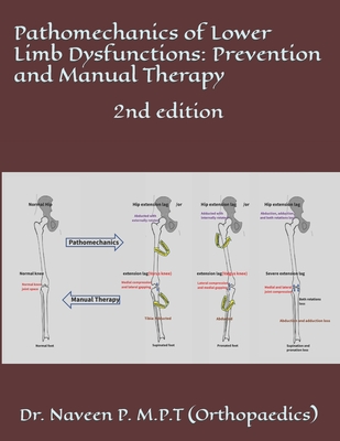 Pathomechanics of Lower Limb Dysfunctions: Prevention and Manual Therapy: 2nd edition - P, Naveen Kumar