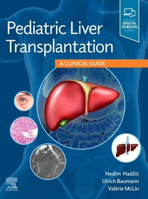 Pediatric Liver Transplantation: A Clinical Guide - Hadzic, Nedim, and Baumann, Ulrich, and McLin, Valrie