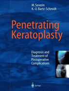 Penetrating Keratoplasty: Diagnosis and Treatment of Postoperative Complications