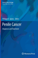 Penile Cancer: Diagnosis and Treatment