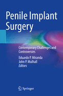 Penile Implant Surgery: Contemporary Challenges and Controversies