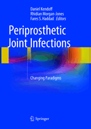 Periprosthetic Joint Infections: Changing Paradigms