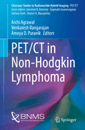 Pet/CT in Non-Hodgkin Lymphoma