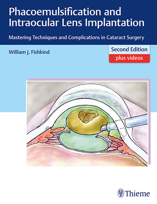 Phacoemulsification and Intraocular Lens Implantation: Mastering Techniques and Complications in Cataract Surgery - Fishkind, William J