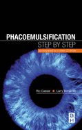 Phacoemulsification: Step by Step: Accompanied by a Video CD-ROM for Window