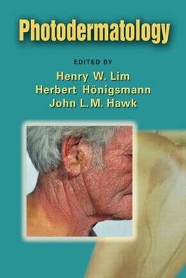 Photodermatology - Lim, Henry W (Editor), and Honigsmann, Herbert (Editor), and Hawk, John L M (Editor)