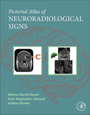 Pictorial Atlas of Neuroradiological Signs - Sharifi-Razavi, Athena, and Ahmadi, Amir Moghadam, and Mowla, Ashkan