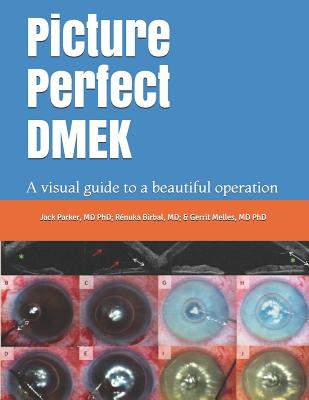 Picture Perfect Dmek: A Visual Guide to a Beautiful Operation - Birbal, Renuka, and Melles, Gerrit, and Parker, Jack
