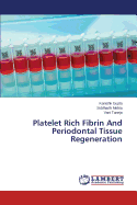 Platelet Rich Fibrin and Periodontal Tissue Regeneration