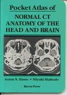 Pocket Atlas of Normal CT Anatomy of the Head and Brain