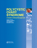 Polycystic Ovary Syndrome: A Guide to Clinical Management