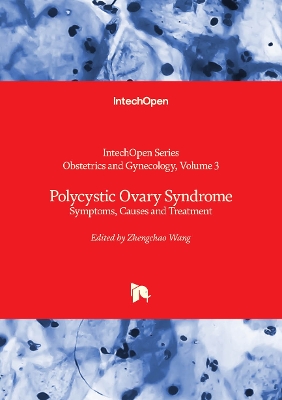 Polycystic Ovary Syndrome: Symptoms, Causes and Treatment - Wang, Zhengchao (Editor)