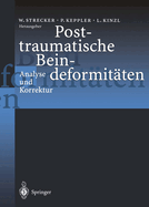 Posttraumatische Beindeformitten: Analyse Und Korrektur