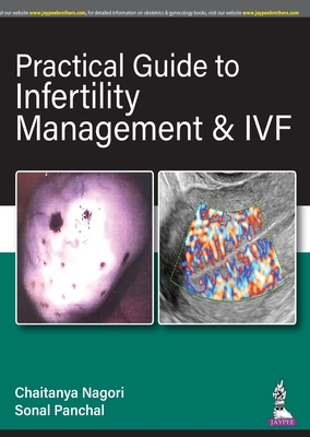 Practical Guide to Infertility Management & IVF - Nagori, Chaitanya, and Panchal, Sonal