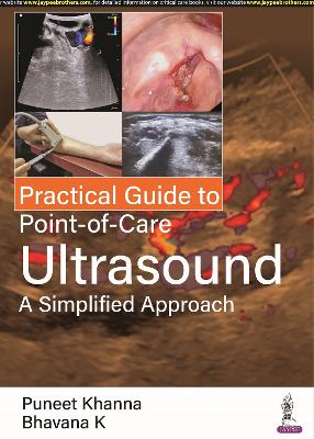 Practical Guide to Point-of-Care Ultrasound: A Simplified Approach - Khanna, Puneet, and K, Bhavana