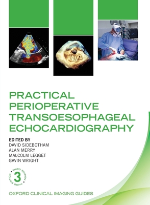 Practical Perioperative Transoesophageal Echocardiography - Sidebotham, David (Editor), and Merry, Alan Forbes (Editor), and Legget, Malcolm E. (Editor)